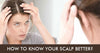 How to Know Your Scalp Better?